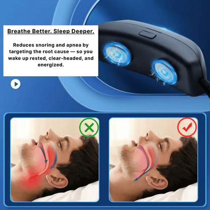 Anti Snoring Device