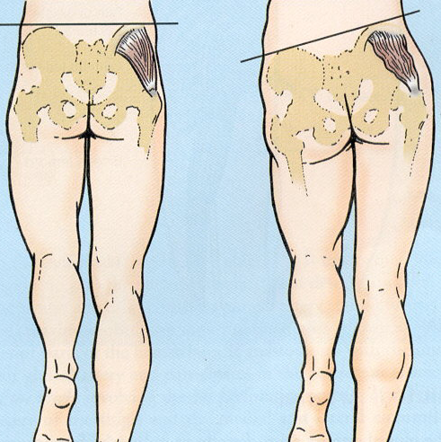 EMS Toning Short | For Dead Butt Syndrome