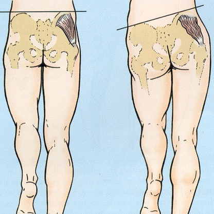 EMS Toning Short | For Dead Butt Syndrome