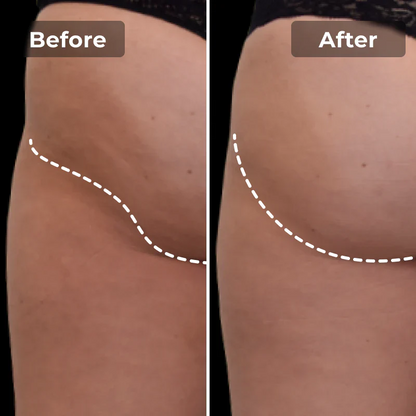 EMS Toning Short | For Cellulite on Bum