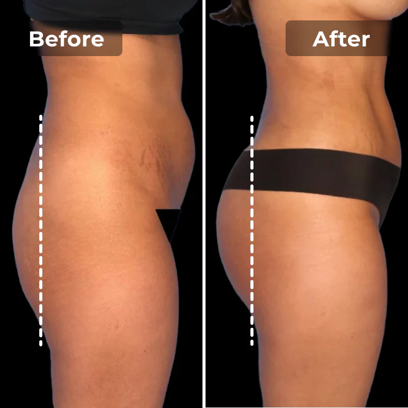 EMS Toning Short | For Lifted & Rounder Glute