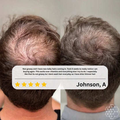 Advanced Hair Growth Serum