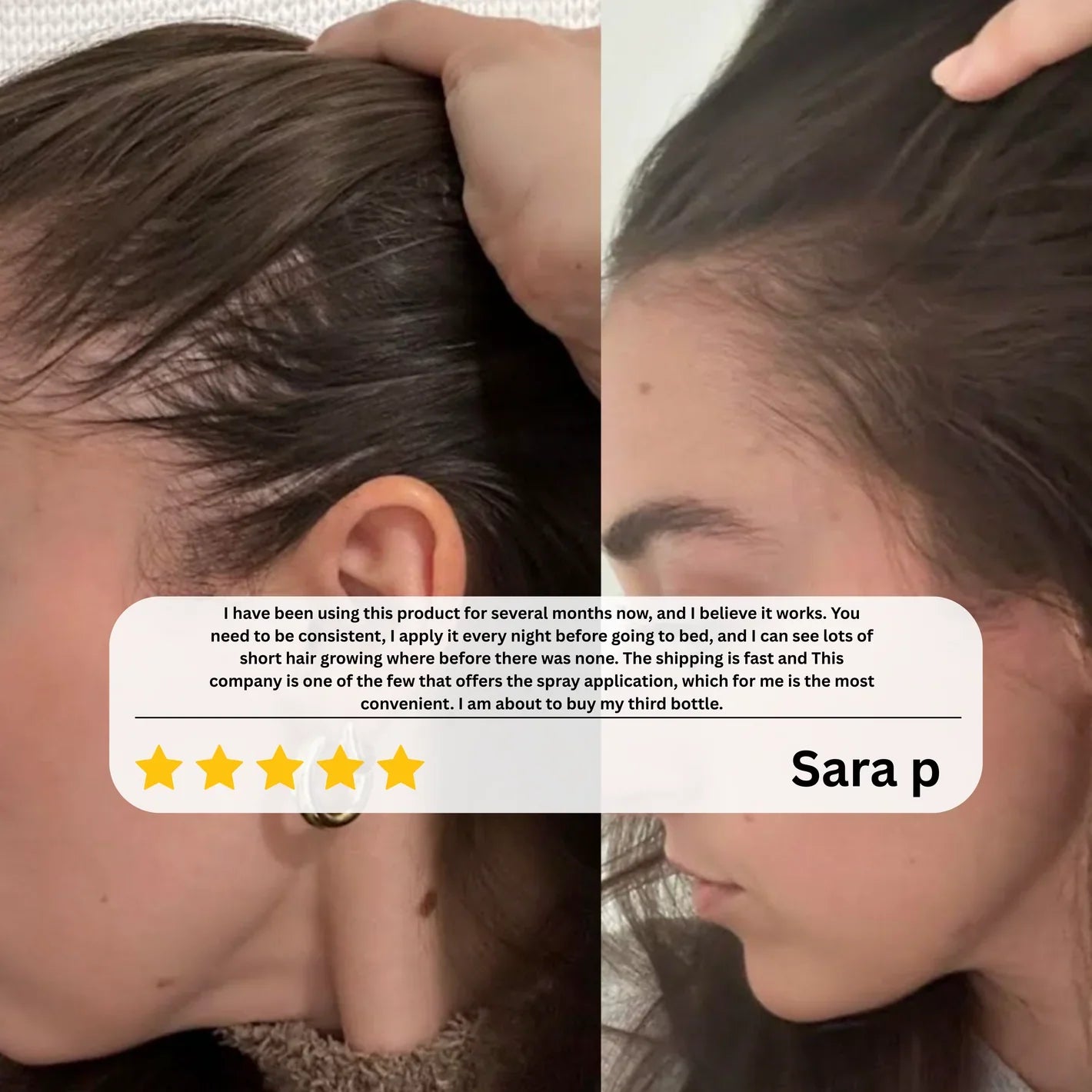 Advanced Hair Growth Serum